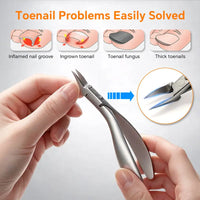 ⏳Time-Limited Special⏰Stainless Steel Ingrown Toenail Clipper and Dead Skin Nipper 2 Piece Manicure Set